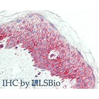 Anti-NCOA3 (RABBIT) Antibody