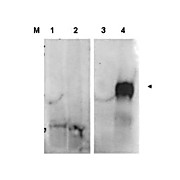 Anti-Fibroblast Activation Protein (FAP) (RABBIT) Antibody