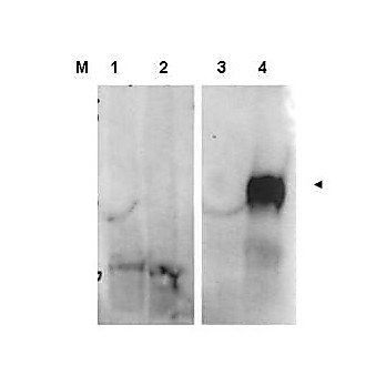 Anti-Fibroblast Activation Protein (FAP) (RABBIT) Antibody