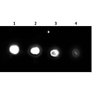 Anti-UREASE (Jack Bean) (RABBIT) Antibody Peroxidase Conjugated