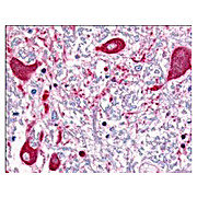 Anti-ROBO-1 (RABBIT) Antibody