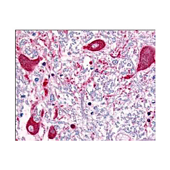Anti-ROBO-1 (RABBIT) Antibody