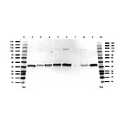 Anti-Glyceraldehyde-3-Phosphate Dehydrogenase (GAPDH) (RABBIT) Antibody