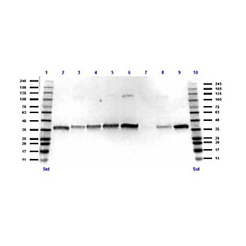 Anti-Glyceraldehyde-3-Phosphate Dehydrogenase (GAPDH) (RABBIT) Antibody