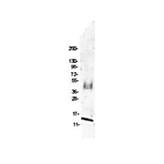 Anti-Swine MIP-1ß (RABBIT) Antibody
