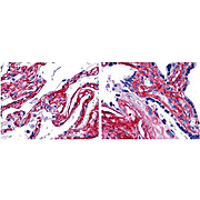 Anti-Collagen Type V (RABBIT) Antibody