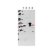 Anti-Thyroid Hormone Receptor alpha (THRA) (RABBIT) Antibody