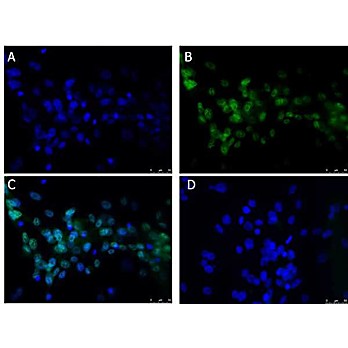 Anti-BCL3 (RABBIT) Antibody