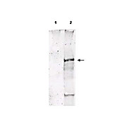 Anti-ATM Protein Kinase pS1981 (SHEEP) Antibody
