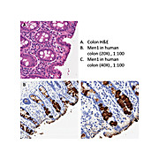 Anti-MEN1 (CHICKEN) Antibody