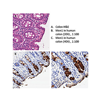 Anti-MEN1 (CHICKEN) Antibody