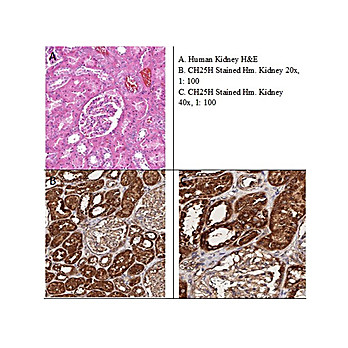 Anti-CH25H (RABBIT) Antibody