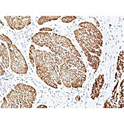 Anti-Ire1 (RABBIT) Antibody