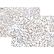 Anti-Smoothened (RABBIT) Antibody