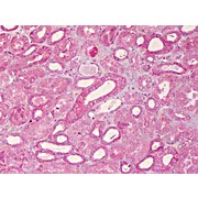 Anti-ABCB1 (RABBIT) Antibody