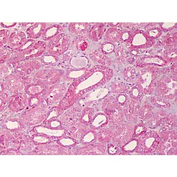 Anti-ABCB1 (RABBIT) Antibody