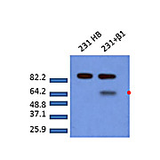 Anti-SMAD2 pS465 pS467 (RABBIT) Antibody