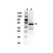 Anti-ALDEHYDE DEHYDROGENASE (RABBIT) Antibody