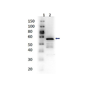 Anti-ALDEHYDE DEHYDROGENASE (RABBIT) Antibody