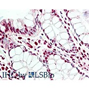 Anti-PRDM1/BLIMP1 (RABBIT) Antibody