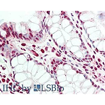 Anti-PRDM1/BLIMP1 (RABBIT) Antibody