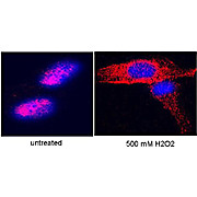 Anti-Telomerase catalytic subunit (RABBIT) Antibody