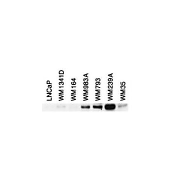 BIN1 Antibody 12A exon