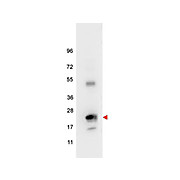 Anti-Human IL-6 (RABBIT) Antibody