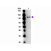 Anti-UREASE (Jack Bean) (RABBIT) Antibody