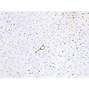 Anti-p35/Cdk5 (RABBIT) Antibody