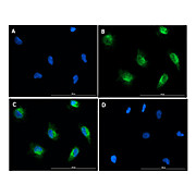 SMAD2 pS467 Antibody