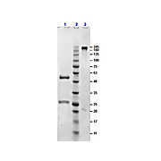 SHEEP Gamma Globulin Fraction
