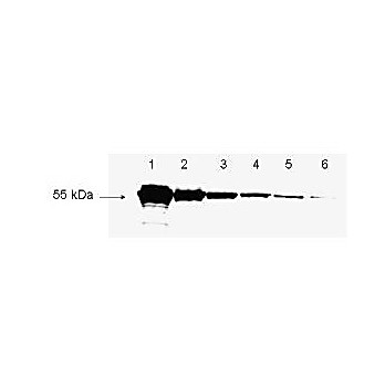 BOVINE/CALF PLASMA (sterile) in Potassium EDTA