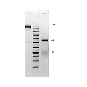 RABBIT Gamma Globulin Fraction