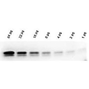 Western Blot Kit Chemiluminescent Western Blot Kit