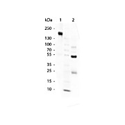 SWINE Gamma Globulin Fraction