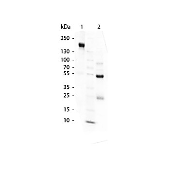 SWINE Gamma Globulin Fraction