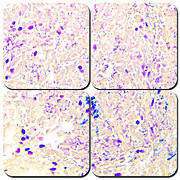 McDonald's Gram Stain Kit