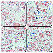 Alkaline Congo Red Amyloid Kit