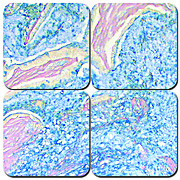 Colloidal Iron Stain Kit