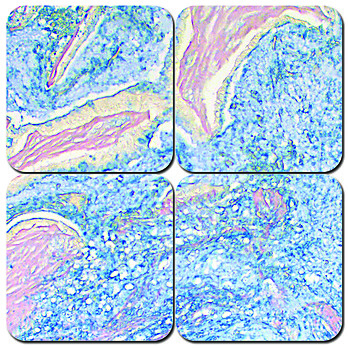 Colloidal Iron Stain Kit 