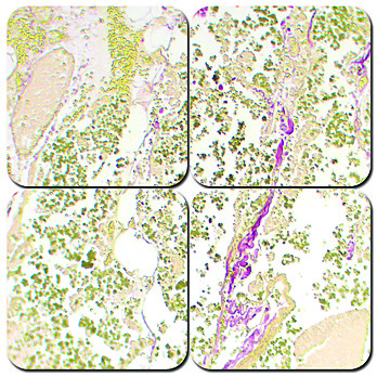 Bile Stain Kit