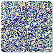 Elastic Stain Kit - Verhoeff's