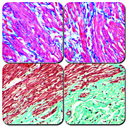 Trichrome Stain Kit - One-Step Blue & Red or Green & Red is available to buy in increments of 1