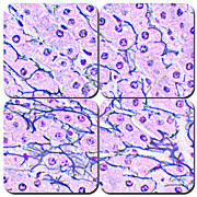 Chandler's Reticulum Stain Kit
