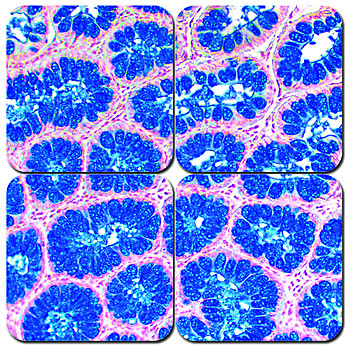 Alcian Blue 2.5pH Stain Kit