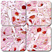 Hepatitis B Stain Kit