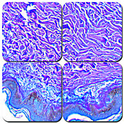 Herovici's Collagen Stain Kit