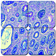 Alcian Blue PAS Stain Kit