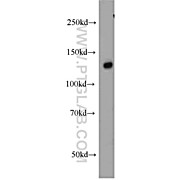 SREBF1 Rabbit Polyclonal Antibody (14088-1-AP)